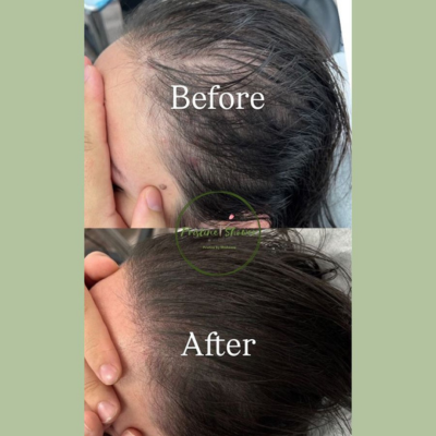 Hibiscus Infused Hair & Scalp Oil