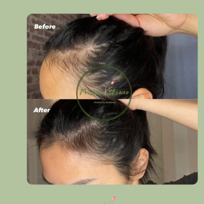 Castor Amla Elixir Hair Oil